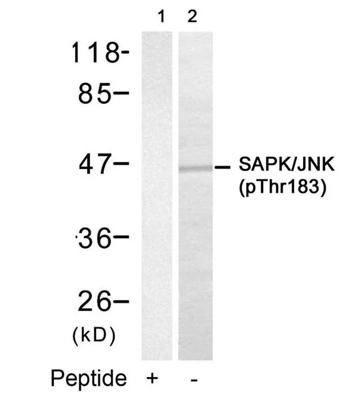 WB analysis of extracts from 293 cells using GTX50278 JNK (phospho Thr183) antibody. Lane 1 : Primary antibody pre-incubated with the antigen specific peptide