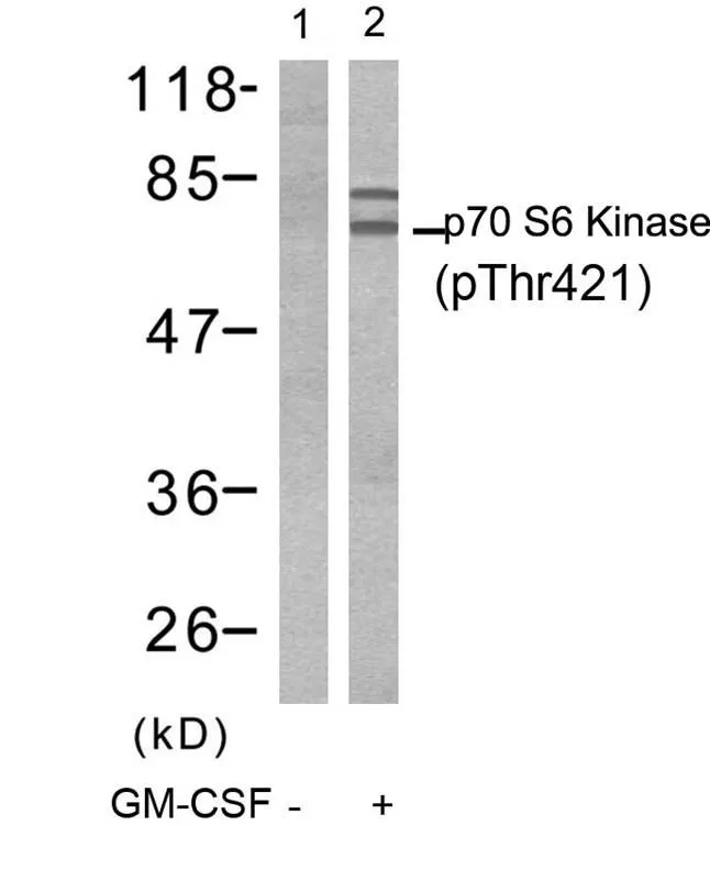 WB analysis of extracts from Jurkat cells untreated (lane 1) or treated with GM-CSF (lane 2) using GTX50282 p70 S6K (phospho Thr421) antibody.