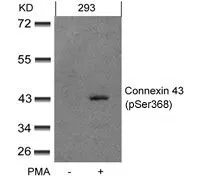 WB analysis of extracts from 293 cells untreated or treated with PMA using GTX50286 Connexin 43 (phospho Ser368) antibody.