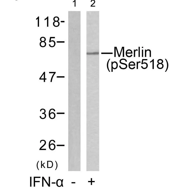 WB analysis of extracts from HUVEC cells untreated (lane 1) or treated with IFN-a (lane 2) using GTX50291 Merlin (phospho Ser518) antibody.