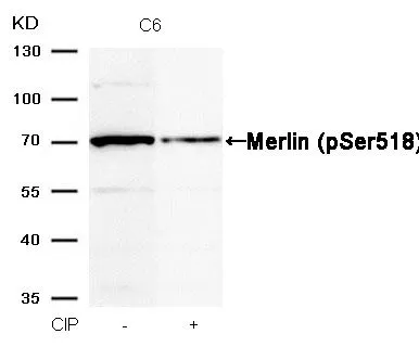 WB analysis of extracts from C6 cells treated with calf intestinal phosphatase (CIP) using GTX50291 Merlin (phospho Ser518) antibody.