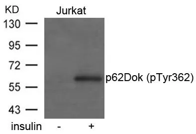 WB analysis of extracts from Jurkat cells untreated or treated with insulin using GTX50297 p62Dok (phospho Tyr362) antibody.