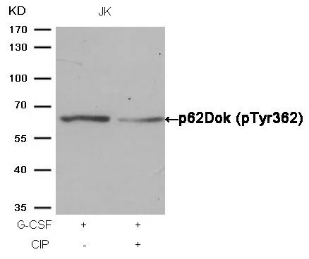 WB analysis of extracts from JK cells treated with G-CSF or calf intestinal phosphatase (CIP) using GTX50297 p62Dok (phospho Tyr362) antibody.