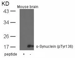 WB analysis of extracts from mouse brain tissue using GTX50306 alpha Synuclein (phospho Tyr136) antibody with or without blocking peptide.