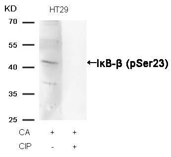 WB analysis of extracts from HT-29 cells treated with CA or calf intestinal phosphatase (CIP) using GTX50317 IKB beta (phospho Ser23) antibody.