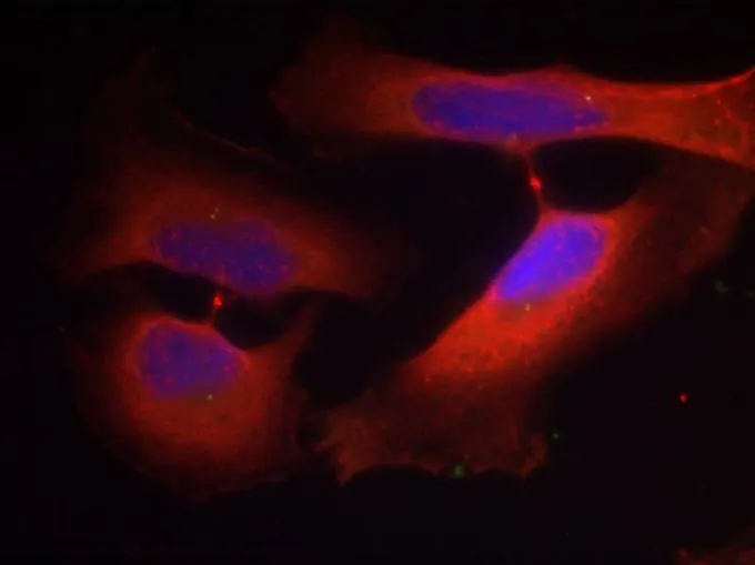 ICC/IF analysis of methanol-fixed HeLa cells using GTX50320 Cytokeratin 8 (phospho Ser74) antibody. ICC/IF analysis of methanol-fixed HeLa cells using GTX50320 Cytokeratin 8 (phospho Ser74) antibody.