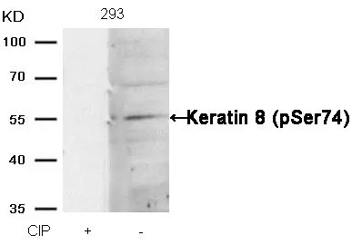 WB analysis of extracts from 293 cells treated with calf intestinal phosphatase (CIP) using GTX50320 Cytokeratin 8 (phospho Ser74) antibody.