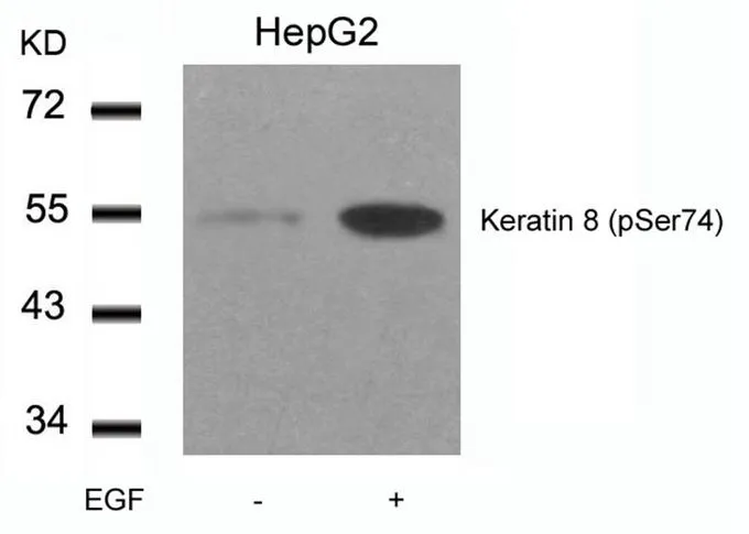 WB analysis of extracts from HepG2 cells untreated or treated with EGF using GTX50320 Cytokeratin 8 (phospho Ser74) antibody.