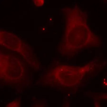 ICC/IF analysis of methanol-fixed HeLa cells using GTX50324 NFkB p105 (phospho Ser927) antibody. ICC/IF analysis of methanol-fixed HeLa cells using GTX50324 NFkB p105 (phospho Ser927) antibody.