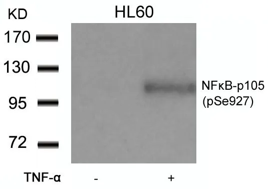 WB analysis of extracts from HL-60 cells untreated or treated with TNF-a using GTX50324 NFkB p105 (phospho Ser927) antibody.