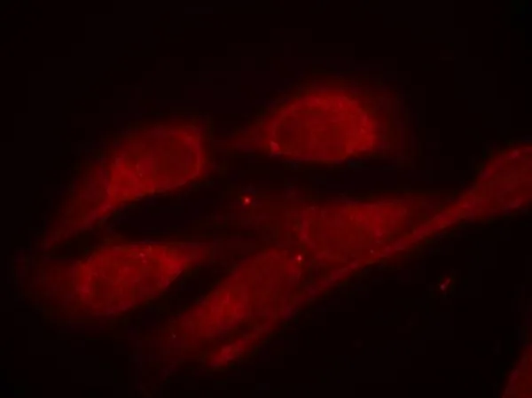 ICC/IF analysis of methanol-fixed HeLa cells using GTX50326 SHC1 (phospho Tyr317) antibody. ICC/IF analysis of methanol-fixed HeLa cells using GTX50326 SHC1 (phospho Tyr317) antibody.