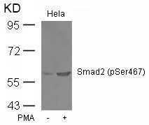 WB analysis of extracts from HeLa cells untreated or treated with PMA using GTX50331 SMAD2 (phospho Ser467) antibody. WB analysis of extracts from HeLa cells untreated or treated with PMA using GTX50331 SMAD2 (phospho Ser467) antibody.