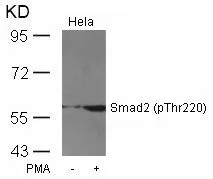 WB analysis of extracts from HeLa cells untreated or treated with PMA using GTX50332 SMAD2 (phospho Thr220) antibody. WB analysis of extracts from HeLa cells untreated or treated with PMA using GTX50332 SMAD2 (phospho Thr220) antibody.