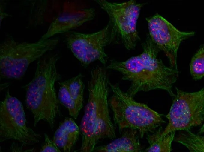 ICC/IF analysis of methanol-fixed HeLa cells using GTX50339 AKT (phospho Thr450) antibody.
