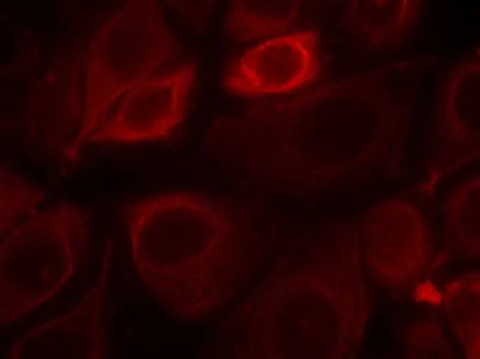 ICC/IF analysis of methanol-fixed MCF-7 cells using GTX50341 Her3 / ErbB3 (phospho Tyr1328) antibody. ICC/IF analysis of methanol-fixed MCF-7 cells using GTX50341 Her3 / ErbB3 (phospho Tyr1328) antibody.