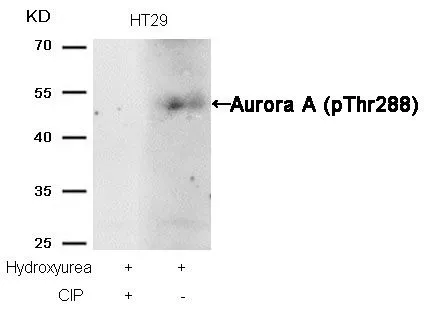 WB analysis of extracts from HT-29 cells treated with Hydroxyurea or calf intestinal phosphatase (CIP) using GTX50345 Aurora A (phospho Thr288) antibody.