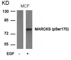 WB analysis of extracts from MCF cells untreated or treated with EGF using GTX50348 MARCKS (phospho Ser170) antibody.