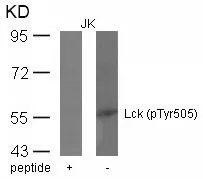 WB analysis of extracts from JK cells using GTX50349 Lck (phospho Tyr505) antibody with or without blocking peptide.