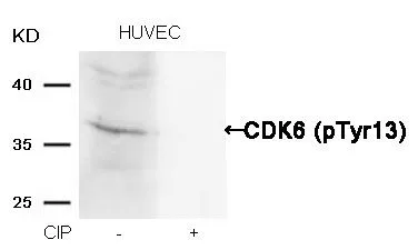 WB analysis of extracts from HUVEC cells treated with calf intestinal phosphatase (CIP) using GTX50352 CDK6 (Phospho Tyr13) antibody.