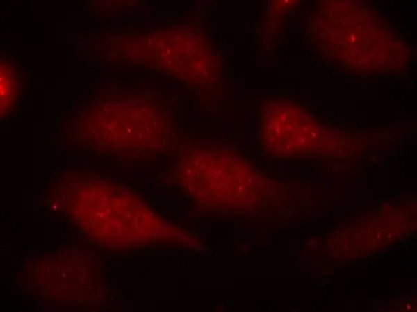 ICC/IF analysis of methanol-fixed HeLa cells using GTX50353 CDK6 (Phospho Tyr24) antibody. ICC/IF analysis of methanol-fixed HeLa cells using GTX50353 CDK6 (Phospho Tyr24) antibody.