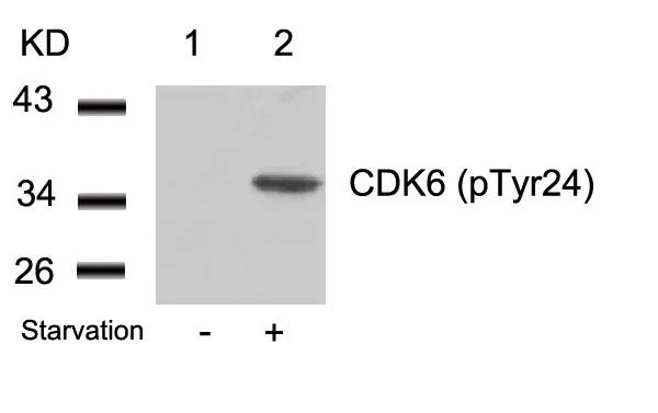 WB analysis of extracts from 293 cells untreated (lane 1) or treated with starvation (lane 2) using GTX50353 CDK6 (Phospho Tyr24) antibody.