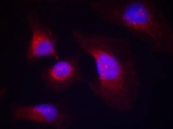 ICC/IF analysis of methanol-fixed HeLa cells using GTX50355 Syk (phospho Tyr323) antibody. ICC/IF analysis of methanol-fixed HeLa cells using GTX50355 Syk (phospho Tyr323) antibody.