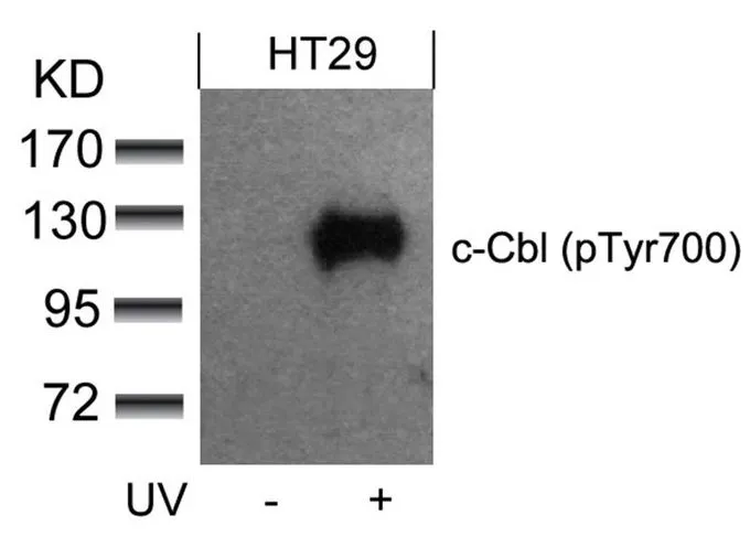 WB analysis of extracts from HT-29 cells untreated or treated with UV using GTX50356 CBL (phospho Tyr700) antibody.