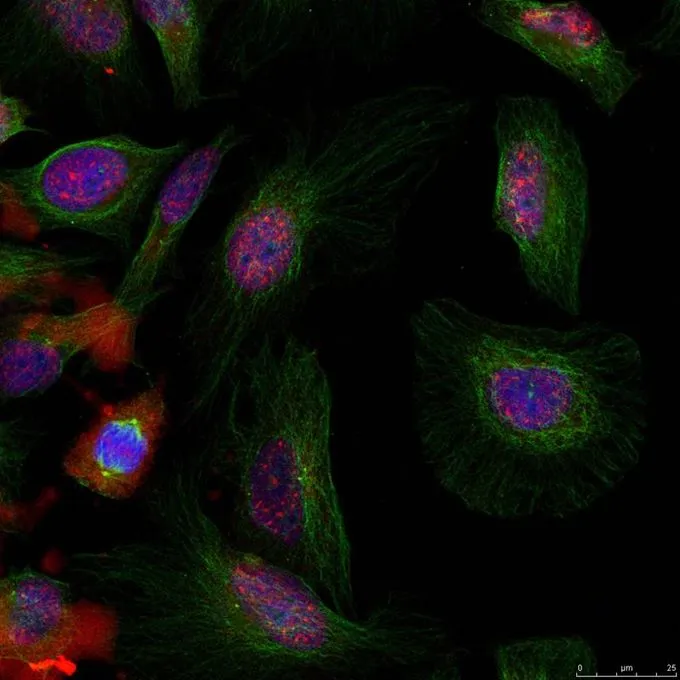 ICC/IF analysis of methanol-fixed HeLa cells using GTX50357 MDM2 (phospho Ser166) antibody. ICC/IF analysis of methanol-fixed HeLa cells using GTX50357 MDM2 (phospho Ser166) antibody.