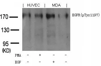 WB analysis of extracts from PMA-treated HUVEC cells or EGF-treated MDA cells using GTX50358 EGFR (phospho Tyr1173) antibody. WB analysis of extracts from PMA-treated HUVEC cells or EGF-treated MDA cells using GTX50358 EGFR (phospho Tyr1173) antibody.