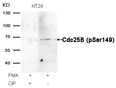 WB analysis of extracts from HT-29 cells treated with PMA or calf intestinal phosphatase (CIP) using GTX50360 CDC25B (phospho Ser149) antibody. WB analysis of extracts from HT-29 cells treated with PMA or calf intestinal phosphatase (CIP) using GTX50360 CDC25B (phospho Ser149) antibody.