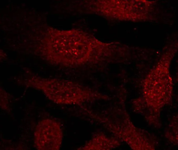 ICC/IF analysis of methanol-fixed HeLa cells using GTX50363 GSK3 beta antibody. ICC/IF analysis of methanol-fixed HeLa cells using GTX50363 GSK3 beta antibody.