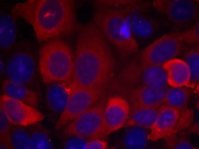 ICC/IF analysis of methanol-fixed MCF-7 cells using GTX50366 PDPK1 / PDK1 antibody. ICC/IF analysis of methanol-fixed MCF-7 cells using GTX50366 PDPK1 / PDK1 antibody.