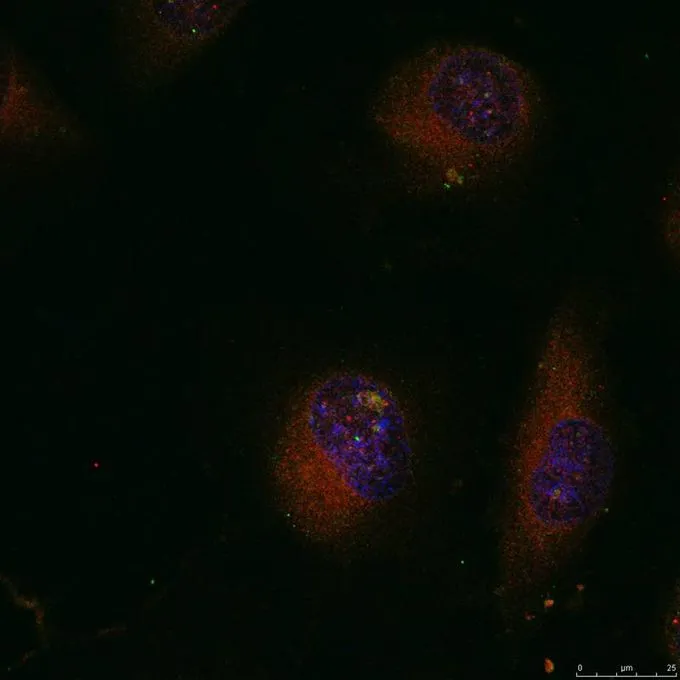 ICC/IF analysis of methanol-fixed HeLa cells using GTX50381 c-Jun antibody. ICC/IF analysis of methanol-fixed HeLa cells using GTX50381 c-Jun antibody.