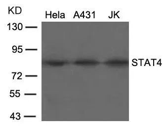 WB analysis of extracts from HeLa, A431, and JK cells using GTX50403 STAT4 antibody.