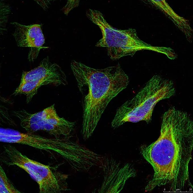 ICC/IF analysis of methanol-fixed HeLa cells using GTX50413 Bcl-2 antibody. ICC/IF analysis of methanol-fixed HeLa cells using GTX50413 Bcl-2 antibody.