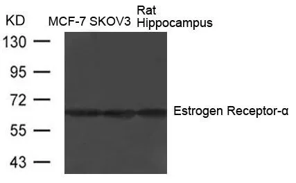 WB analysis of extracts from MCF-7 using GTX50418 Estrogen Receptor alpha antibody.