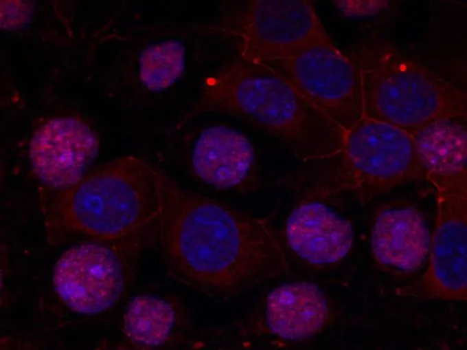ICC/IF analysis of methanol-fixed MCF cells using GTX50421 Estrogen Receptor alpha antibody. ICC/IF analysis of methanol-fixed MCF cells using GTX50421 Estrogen Receptor alpha antibody.