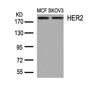 WB analysis of extracts from MCF and SKOV3 cells using GTX50425 Her2 / ErbB2 antibody.