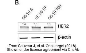 The data was published in the journal Oncotarget in 2018. PMID: 29765526
