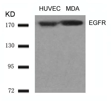 WB analysis of extracts from HUVEC and MDA cells using GTX50426 EGFR antibody.