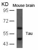 WB analysis of extracts from mouse brain tissue using GTX50445 Tau antibody.