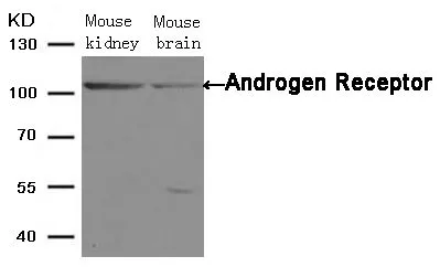WB analysis of extracts from mouse kindey and brain tissue using GTX50455 Androgen Receptor antibody. WB analysis of extracts from mouse kindey and brain tissue using GTX50455 Androgen Receptor antibody.