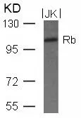 WB analysis of extracts from JK cells using GTX50460 Rb antibody.