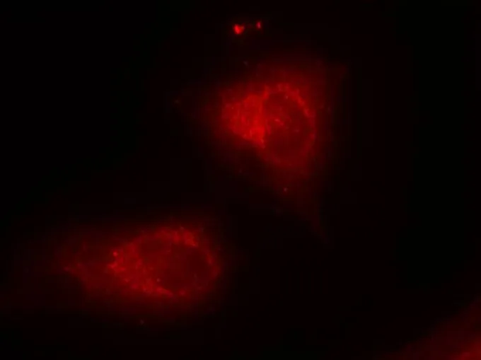 ICC/IF analysis of methanol-fixed HeLa cells using GTX50468 IKB alpha antibody. ICC/IF analysis of methanol-fixed HeLa cells using GTX50468 IKB alpha antibody.