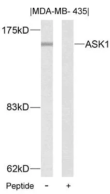 WB analysis of extracts from MDA-MB-435 cells using GTX50471 ASK1 antibody with or without blocking peptide.