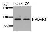 WB analysis of extracts from PC12 and C6 cells using GTX50477 NMDAR1 antibody. WB analysis of extracts from PC12 and C6 cells using GTX50477 NMDAR1 antibody.