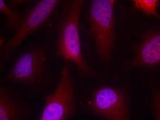 ICC/IF analysis of methanol-fixed HeLa cells using GTX50479 p90 RSK1 antibody.