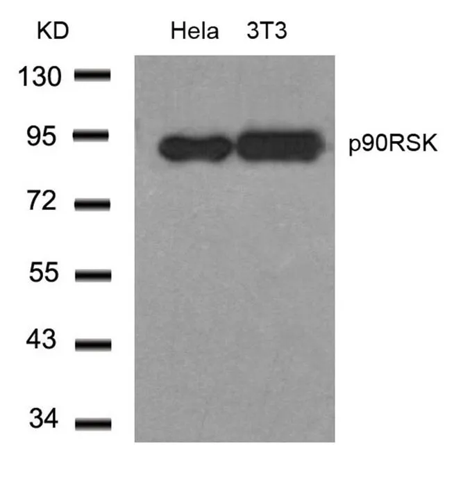 WB analysis of extracts from HeLa and 3T3 cells using GTX50479 p90 RSK1 antibody. WB analysis of extracts from HeLa and 3T3 cells using GTX50479 p90 RSK1 antibody.