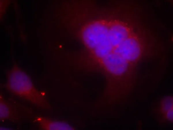 ICC/IF analysis of methanol-fixed HeLa cells using GTX50482 FOXO1 antibody. ICC/IF analysis of methanol-fixed HeLa cells using GTX50482 FOXO1 antibody.