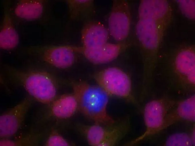 ICC/IF analysis of methanol-fixed HeLa cells using GTX50488 ATM antibody. ICC/IF analysis of methanol-fixed HeLa cells using GTX50488 ATM antibody.